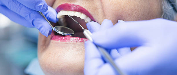Best Knocked-Out Tooth (Avulsed Tooth) Treatment in Tellico Plains, TN